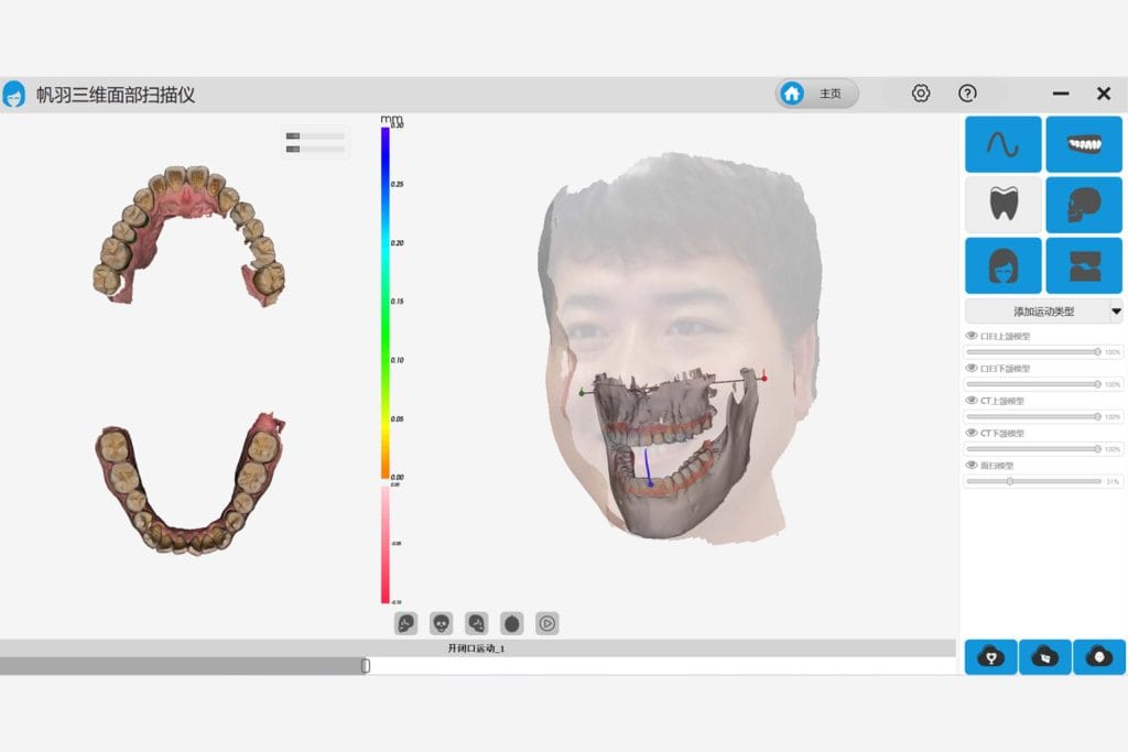 Scaner facial 3d și arc facial digital 6 - Super Dent Distribution Reconstrucția ocluzală