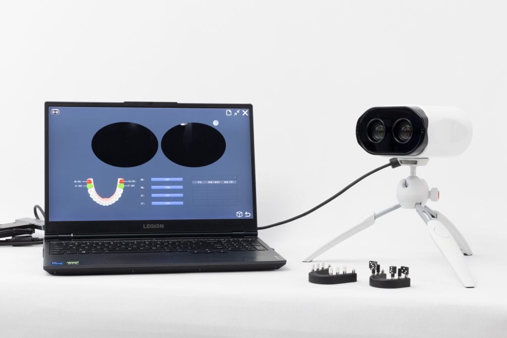 Scanner fotogrammetric dentar PALM 2 - Super Dent Distribution Scanner fotogrammetric dentar PALM – amprentare digitală rapidă, precisă și confortabilă